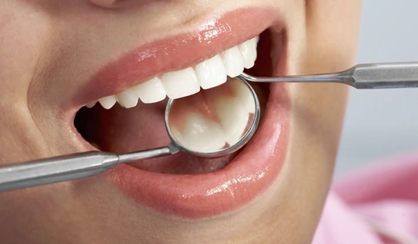 Only 1 in 10 People Can Correctly Identify All These Dental tools